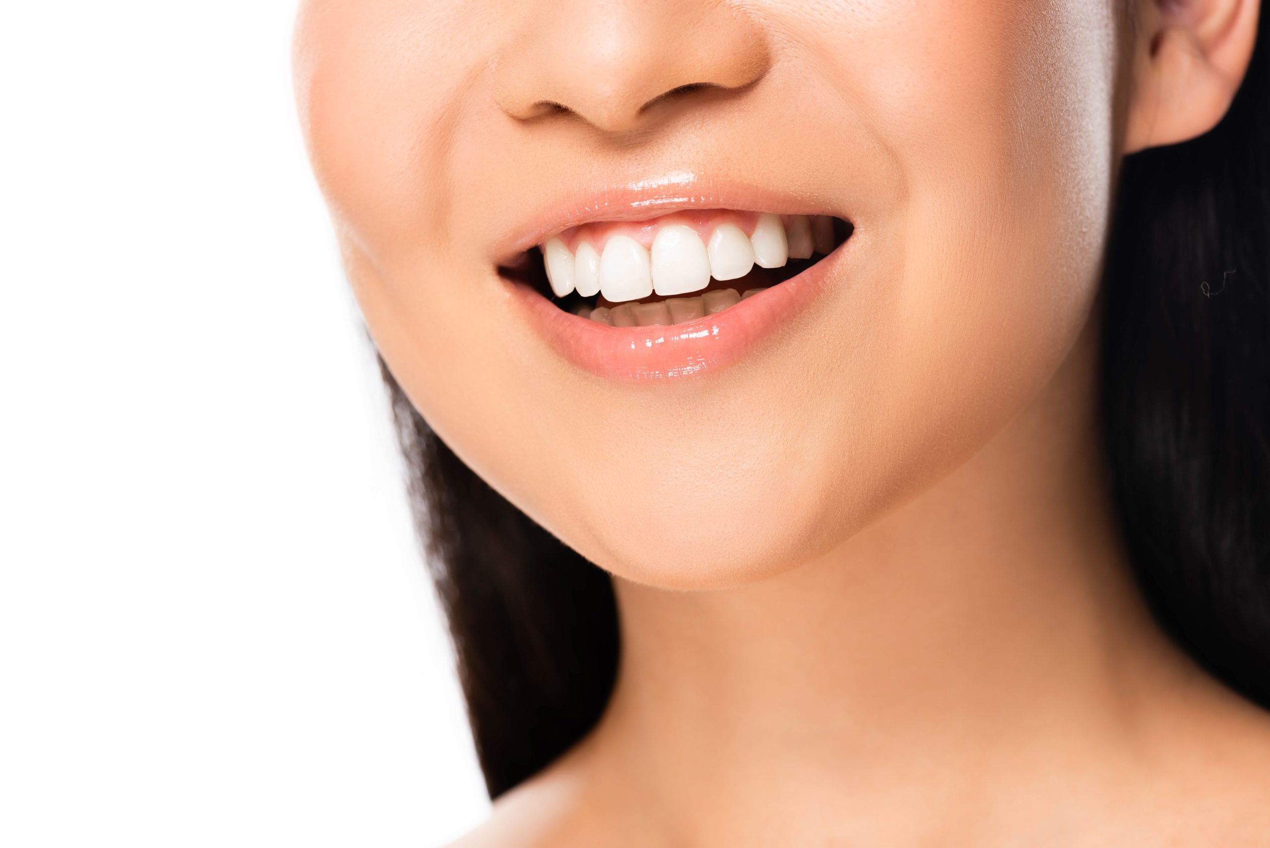 Are veneers permanent or removable